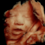 4D Sprouts 3D 4D HD Ultrasounds Sarasota Florida-50