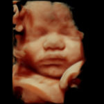 4D Sprouts 3D 4D HD Ultrasounds Sarasota Florida-7