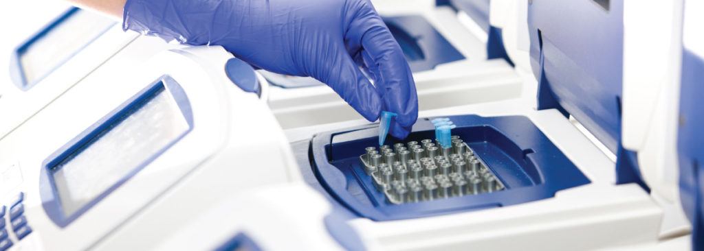 early gender DNA testing bradenton FL