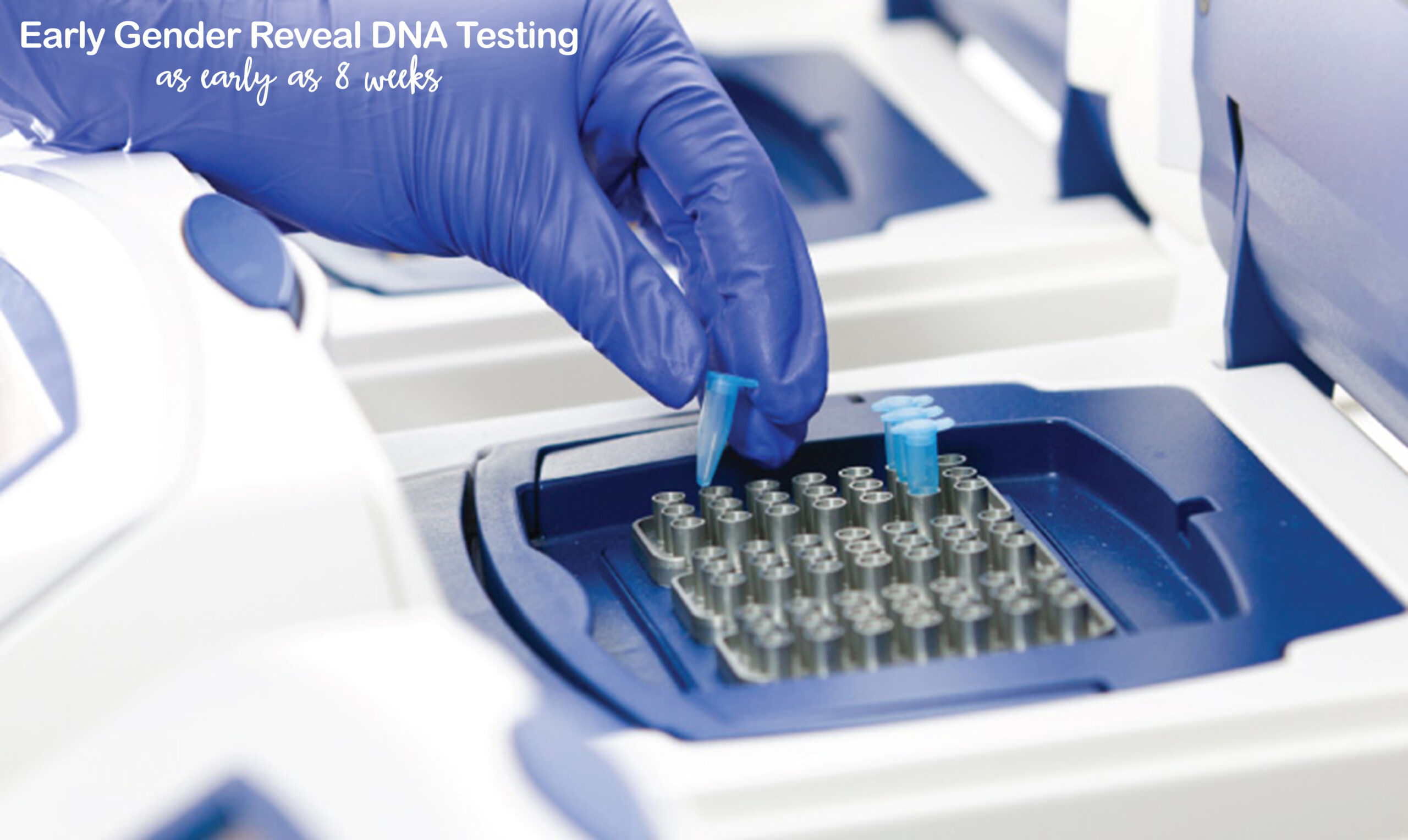 early gender DNA test Sarasota FL 4d ultrasound sarasota FL 3D ultrasound bradenton fl 3D 4D sonogram north port fl 3D 4D ultrasound port charlotte FL